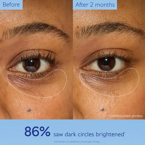Vista 5 de Caudalie Vinoperfect Dark Circle - Crema de ojos iluminadora con cafeína con niacinamida, sin fragancia, 0.5 fl oz