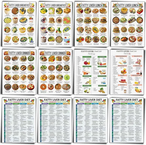 Vista 20 de Sinload 12 piezas de póster de dieta de alimentos para reflujo ácido, lista de dieta para ERGE, alimentos bajos en ácido, lista de compras