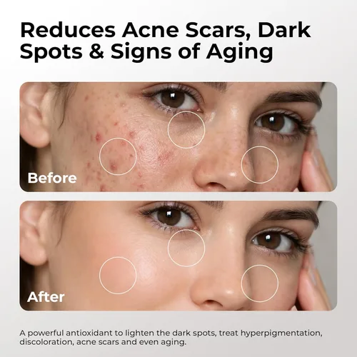 Vista 6 de SKIN DEVA Suero con 20% de vitamina C para la cara con vitamina E Plus ácido ferúlico suero para el cuidado de la piel 1 fl oz 1.0 fl oz rejuvenece