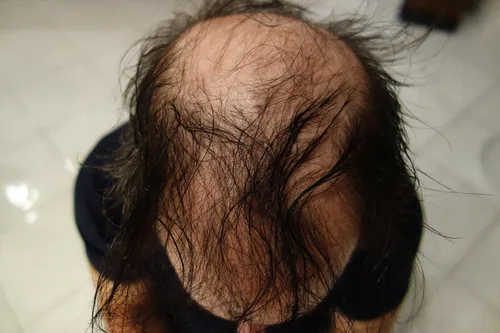 Vista 4 de Edificio de pelo fibras 100 gramos Refill su botella existente. Grado más alto por por último Hair