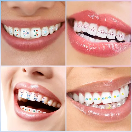 Vista 4 de Sosation 377 piezas de gemas de dientes para dientes, kit de joyería DIY de cristal artificial de moda diente reflectante para fiesta de cumpleaños