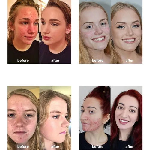 Vista 4 de Paquete de 2 PHOERA Base, Crema Correctora Mate Control de Grasa, PHOERA Base Líquida Mate Impermeable de Larga Duración para Mujeres y Niñas